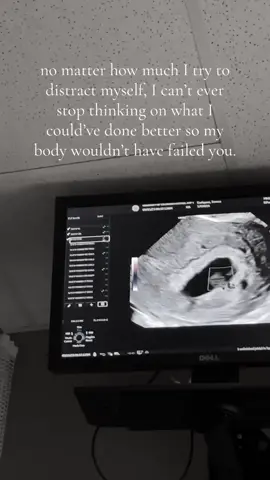 I will forever grieve you my pumpkin. 👼🏻 #miscarriage #littlepumpkin #fyp  