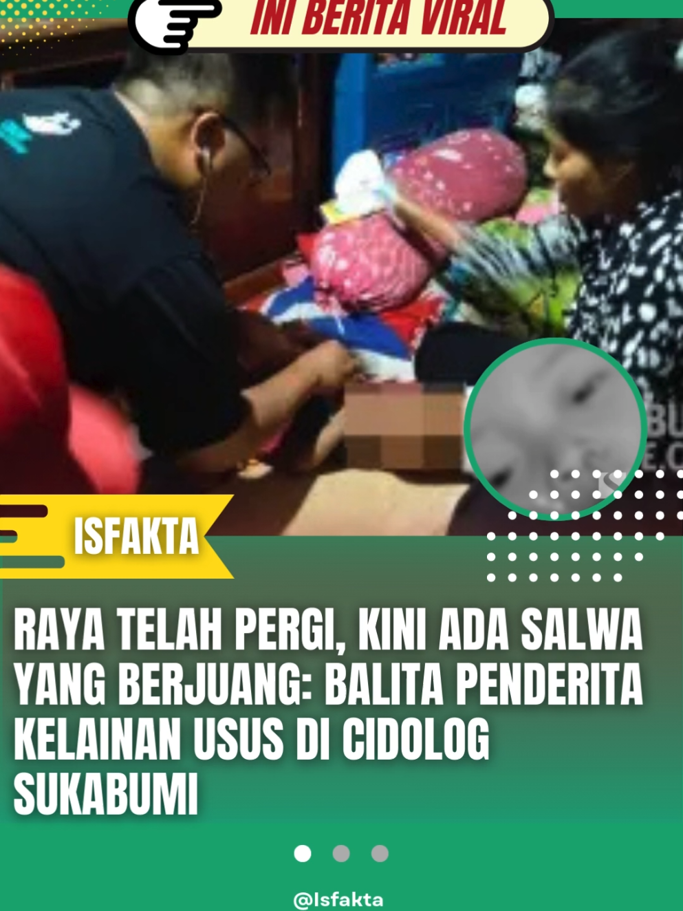 Setelah kasus meninggalnya Raya (3) akibat penyakit cacing, muncul kisah Salwa Aulia Khoerunnisa (2) dari Kampung Sikluk, Desa Tegallega, Kecamatan Cidolog, Kabupaten Sukabumi. Salwa menderita kelainan bawaan acquired rectovestibular fistula, membuat usus dan rektum tersambung abnormal ke jalur vagina. Putri pasangan Usep Supriatna (36) dan Enah Mulyani (28) ini sudah empat kali menjalani operasi besar dan menunggu operasi kelima enam bulan mendatang. Meski biaya medis ditanggung BPJS, keluarga kesulitan membiayai transportasi rutin ke RSHS Bandung dan kebutuhan sehari-hari. Usep bekerja serabutan dan tinggal menumpang di rumah mertua. Kepala Puskesmas Cidolog, Cepi Hermansyah, menyebut persoalan utama adalah keterbatasan ekonomi. Salwa memerlukan kantong kolostomi pascaoperasi, namun karena mahal, keluarga membuatnya dari plastik kiloan yang berisiko kebersihan. Puskesmas dan Pemdes sudah membantu pembuatan BPJS dan pendampingan rujukan. Kondisi Salwa kini stabil dan pengobatan berlanjut sesuai arahan dokter. Keluarga berharap bantuan pihak lain untuk biaya transportasi, akomodasi, dan kebutuhan medis di luar tanggungan BPJS. Kasus Salwa mengingatkan pada tragedi Raya, balita Desa Cianaga yang meninggal 22 Juli 2025 dengan tubuh dipenuhi cacing gelang. Raya sempat dirawat tanpa identitas dan jaminan kesehatan, membuat biaya rumah sakit membengkak, sebelum kisahnya terungkap melalui unggahan komunitas Rumah Teduh.#viral #salwa #bocah #sukabumi 