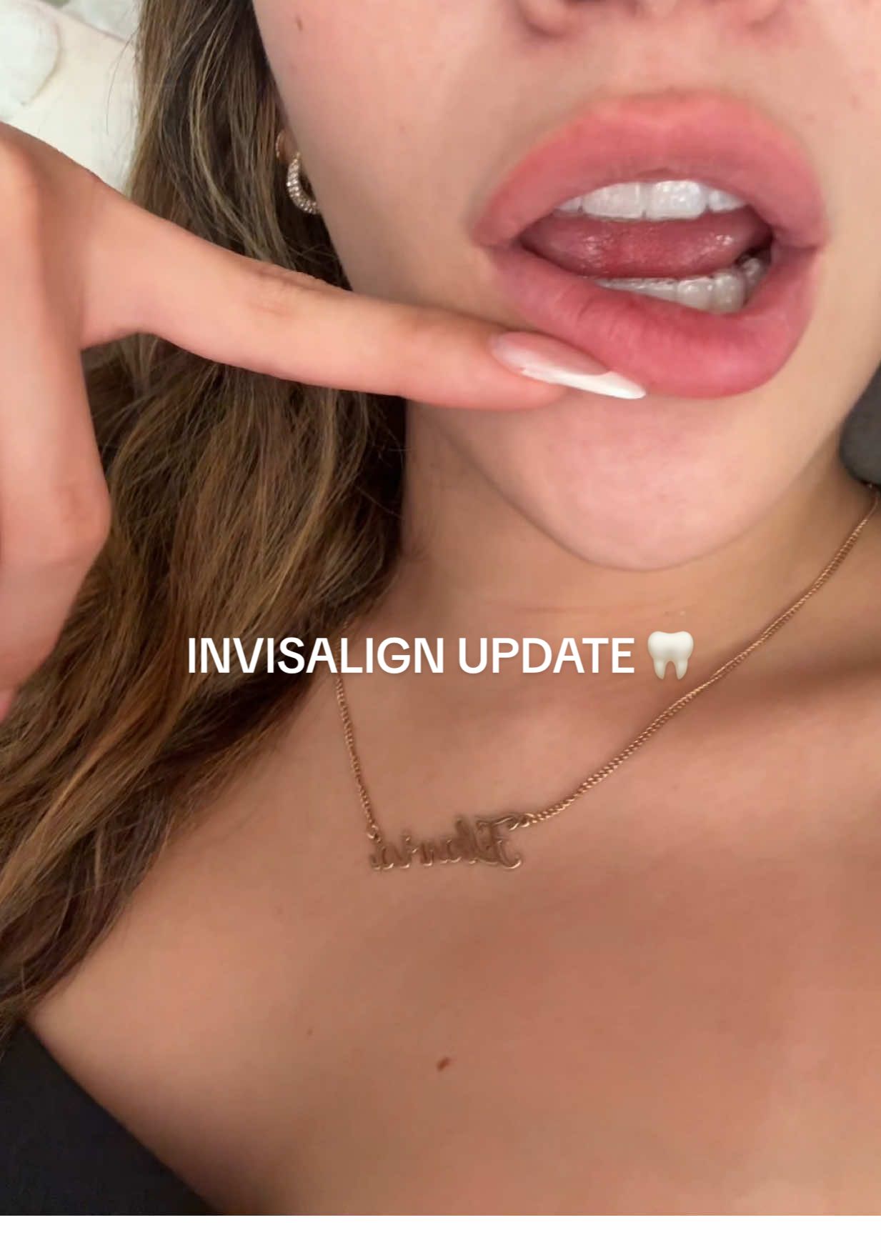 INVISALIGN UPDATE!!! 🦷 another pro is that they make ur teeth look BUSSSINNN in pictures/videos 🤣🤣 #invisalign #flaviacucalon #hasstraightahhhteeth 