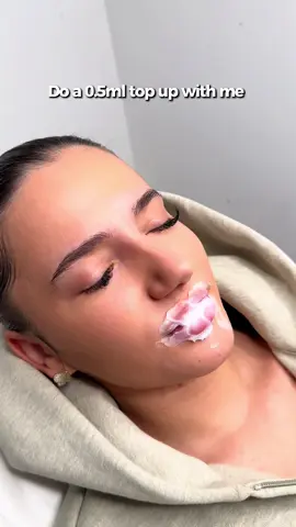 0.5ml top up in 30seconds 😍 #lipfiller #birminghamaestheticians #fyp #russianlipstechnique 