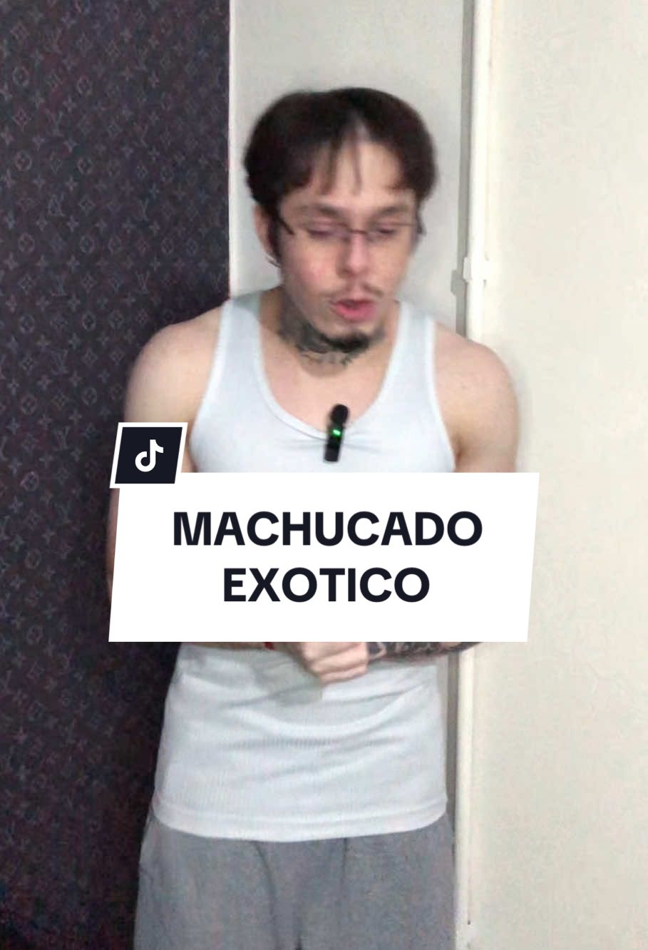 Vai me falar que foi o anelar. #machucado #humor #vidareal #kiozin 