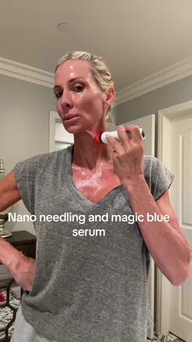 Glow up for the win! #microneedling #nanoneedle 
