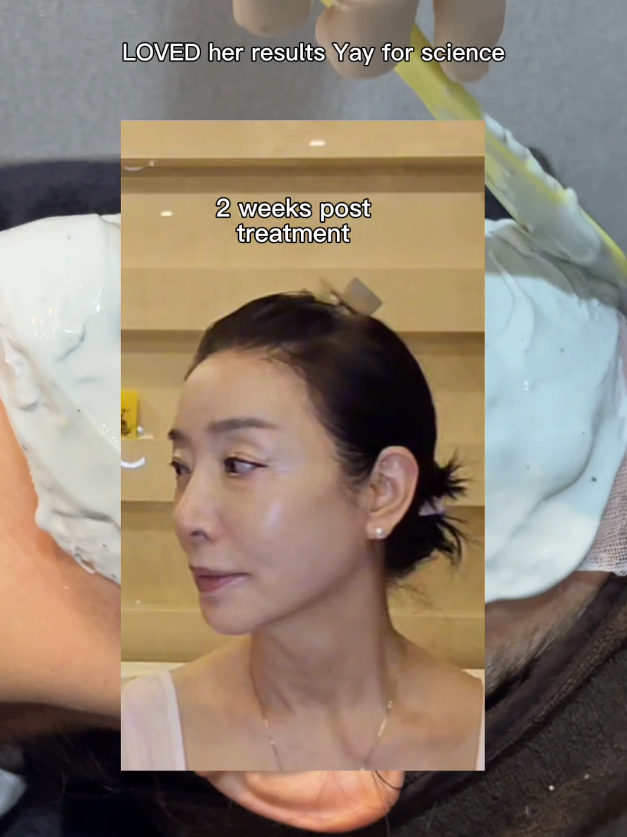 I took my mom to get a stem cell treatment bc she's been through a lot the past few years. Please check up on your parents. If you are looking into stem cell therapy I highly recommend @Girin Plastic Surgery Clinic 🩷 