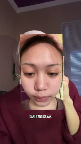 Perawatan dari dalam aku💗 #sheebycollagenbooster #sheebybeauty #collagenbooster #collagen #fyp 