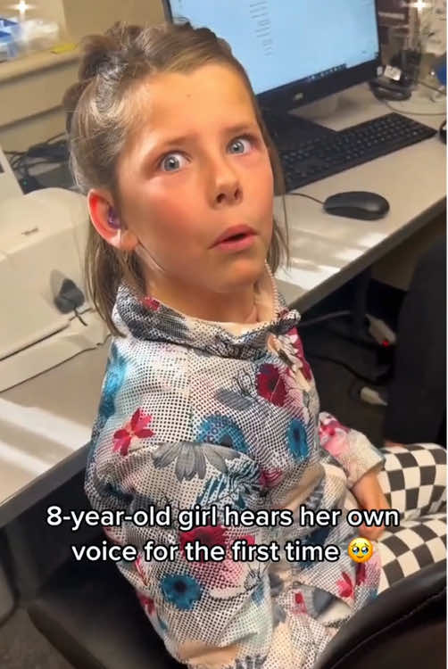 For the first time, a child hears the world clearly-and their own voice thanks to a hearing aid.🥹🥹#hearingaids #firsttimehearing #childhoodmoments #newbeginnings #hearingjourney #soundofhope #hearingtheworld #communication #discovery #inspiration #hearingloss #deafawareness #hearingimpairment #hearingdisability #hearingcommunity #deafpride #cry #accessiblehearing #hearingaccessibility #deafeducation #hearinghealth #foryou #fyp 