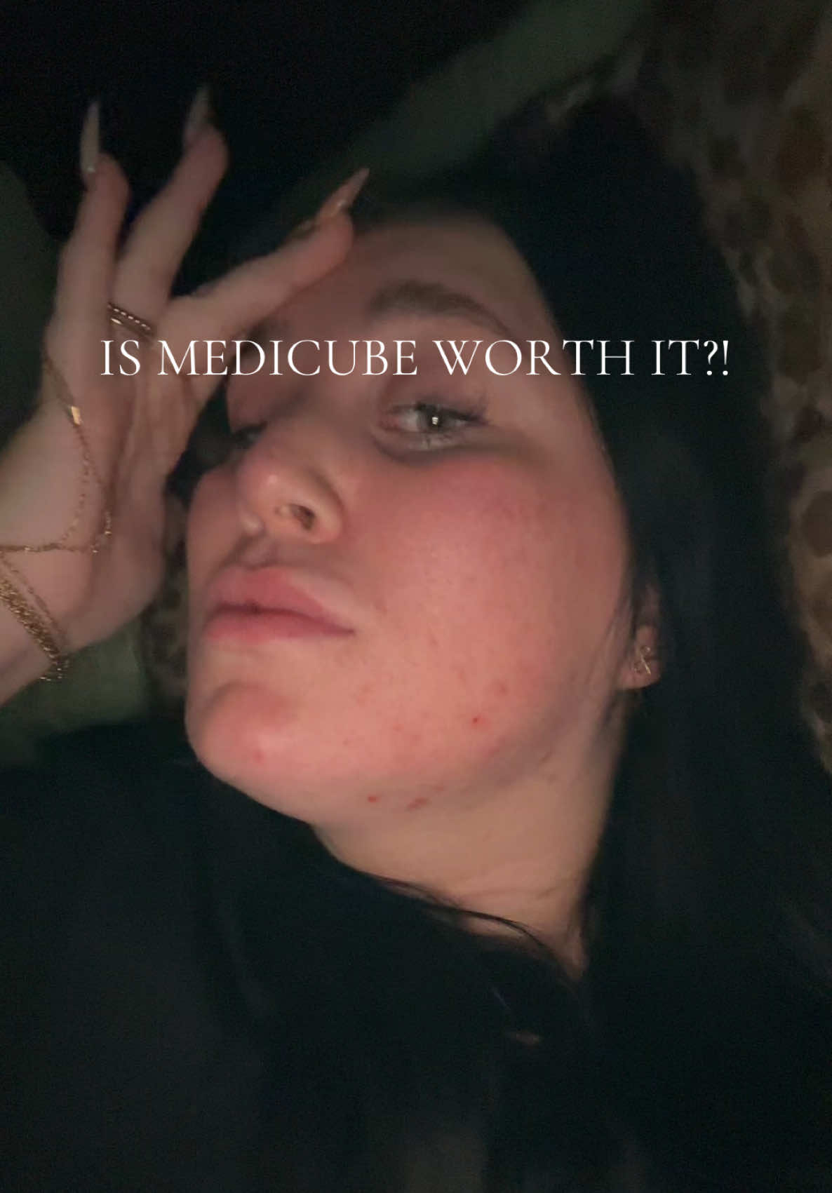 I just want the acne GONE😭😭😭😭😭😭  @medicube global  #medicube #acne #helpme #acneproneskin #foryouu 