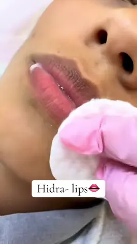 Hidra- Lips💋#womanbellsedecomas #womanbellmiraflores #cuidadodelapiel #pinkglow #limaperu🇵🇪 
