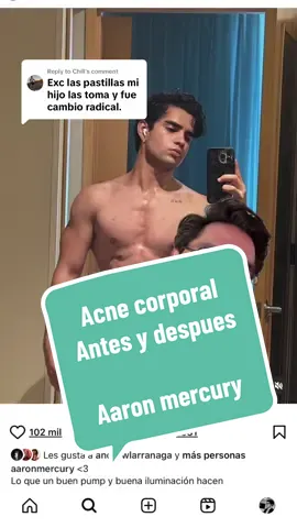Replying to @Chill @Aaron Mercury #aaronmercury #acne #retinol #lcdlf 