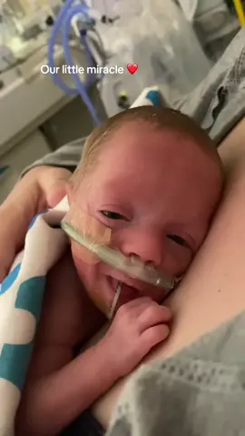One month old. 1 lb 11 oz. Born at just 26 weeks. 💙 Watching this now, it feels like yesterday… and yet today Hudson is 4 years old, running, laughing, and showing us what true strength looks like. Saying a special prayer today for every NICU baby, every mama and dad sitting by an isolette, and every nurse, doctor, and therapist who pour their hearts into these tiny fighters. You are forever near and dear to mine. 💙🙏 #NICUStrong #PreemieWarrior