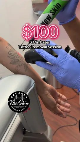 Laser tattoo removal is affordable with us here at New Skin Tattoo Removal. These tattoos were treated in 3 minutes for $100 by me, Nurse Cynthia at my Pop-Up Clinic, San Jose, CA. We do not charge per square inch of a tattoo like those other guys.  DM us ‘LASER ME’ to get started with your affordable tattoo removal journey today! Learn more about us here: www.newskintr.org #creatorsearchinsights #tattooremovalprice #lasertattooremoval #tattooregret #tattooremoval 