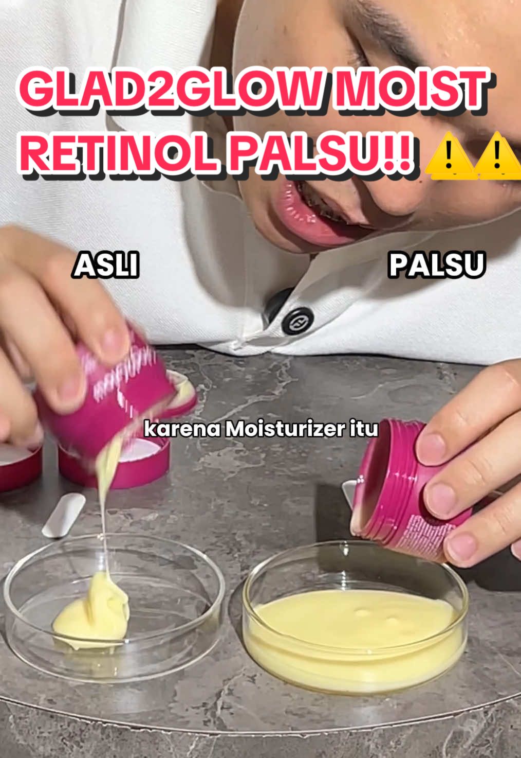 Glad2Glow Moisturizer Retinol Palsu ⚠️⚠️ Ini kalian wajib tonton! Ini parah banget! Tidak masuk akal moisturizer ada wangi Alkohol! Dan yang paling mengerikan kita tidak tau isiannya apa, yang ditakutkan ada bahan berbahaya yang kita tidak tau. Apakah mungkin Merkuri? Tidak ada yang tau juga kecuali di Cek lab Cek Glad2Glow milik kalian apakah ada yang teksturnya se encer ini? Share ke orang yang kalian peduli dan follow akun kosteve untuk rekomendasi #yangPastipastiaja #pastipastiaja #glad2glow #glad2glowmoisturizer #glad2glowskincare 