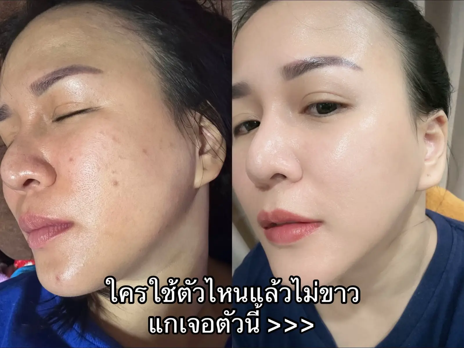 เซตนี้ขาวเร็ว ใสเร็ว ใช้ตามไม่ผิดหวัง ‼️ #ผิวขาว #ผิวใส #รีวิวบิวตี้ #ของดีบอกต่อ ##skincare