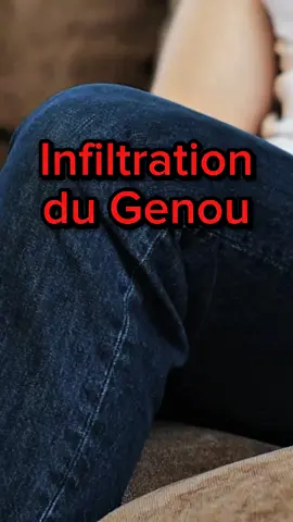 L'infiltration du genou est une technique médicale qui consiste à injecter un liquide dans l'articulation malade. Cette méthode a pour objectif  de diminuer l'inflammation de la zone à l'origine de la douleur et/ou du gonflement du genou. #medical #infiltration #genou #articulation #santé 