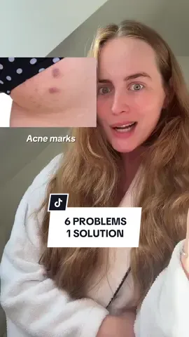 6 problems 1 solution ✅ Take your pick! #chickenskin #acneproneskin #dryskin #skintips #exfoliate 