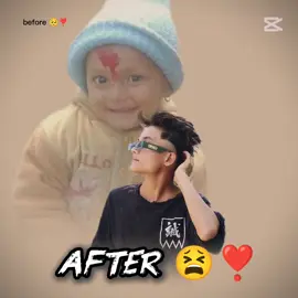 #capcut #beforeandafter #photoshoot  #foryoupage #capcut_edit photo 💙 child photo 🥺❣️ after photo 😫❣️
