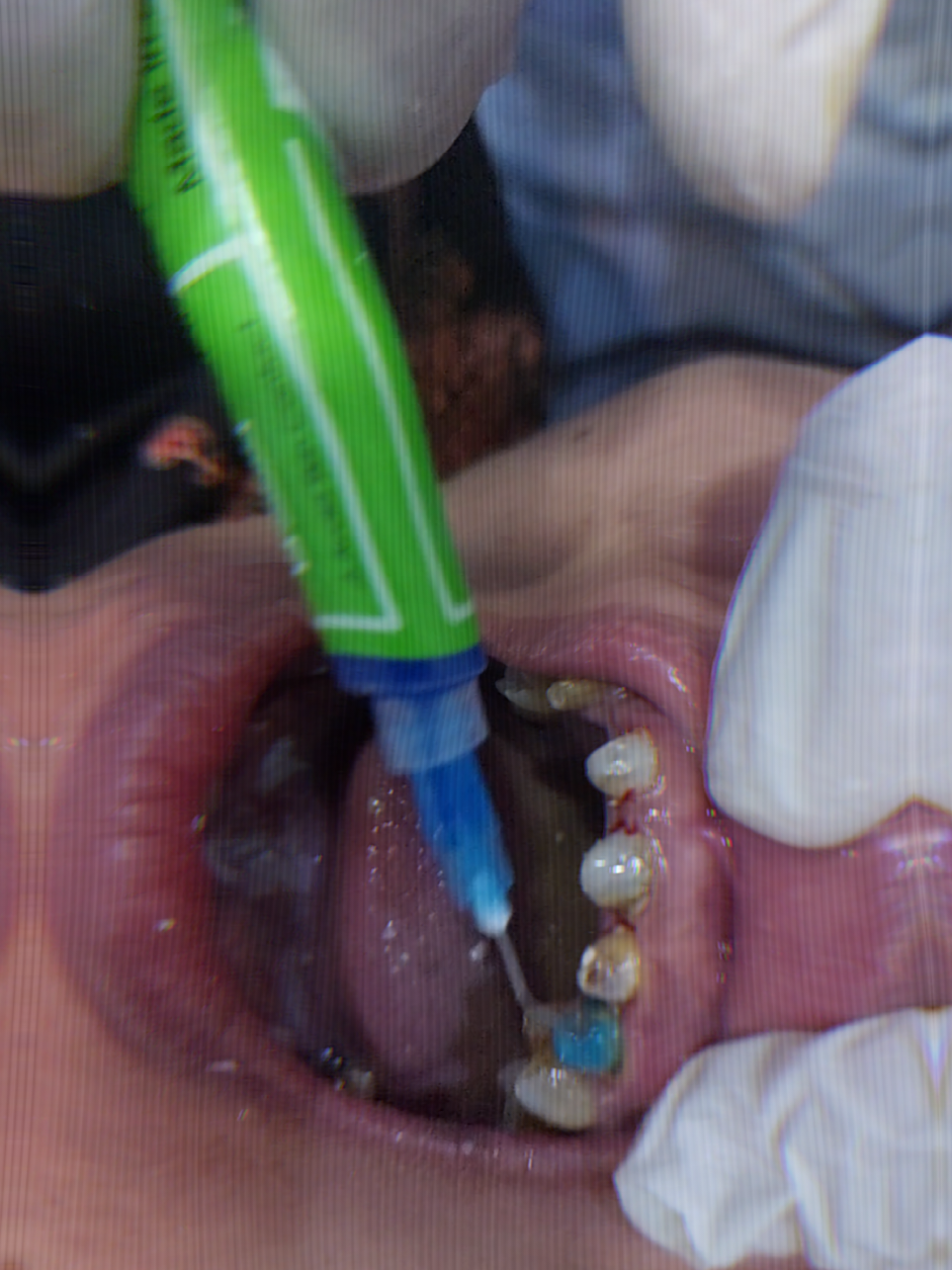 Family Dental Care  #smile #dentist #smilemakeover #drfatima 