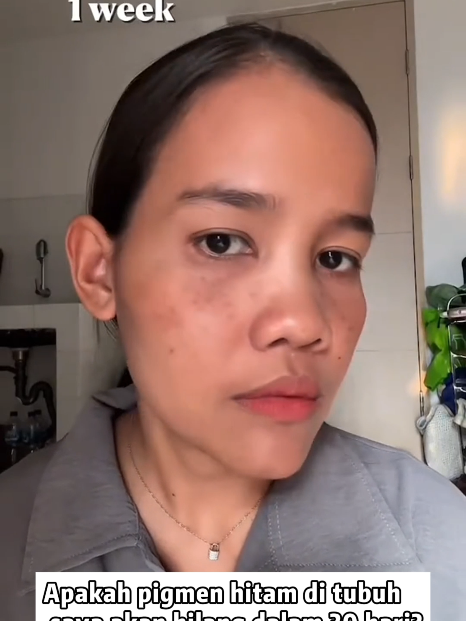 Segera dapatkan cream penghilang bercak ini sekarang❗❗❗#fyppppppppppppppppppppppp #masukberandafyp #wajibcoba #solusijerawat #ForYourBeauty #skincareroutine #skincareviral #viralvideo1million #produkhemat #chalonesecreamwhiteningandfreckleremoval #skincaretips #chalonese #chaloneseskincare #garishalus #wajahglowing #cerahglowing