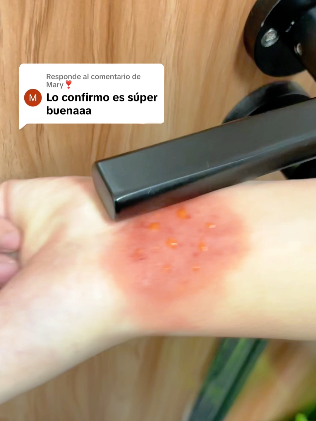 Calma la piel sensible e irritada de manera natural, dale el descanso que merece #pielsensible #cuidadoDeLaPiel #remediosnaturales #bienestar #rutinasaludable #00