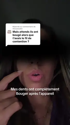 Réponse à @titenanou83 regardez les dents que j’avais à la fin svp 