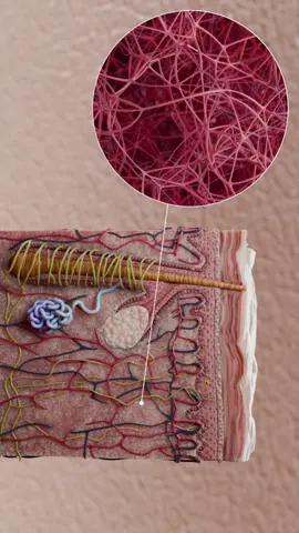 Microneedling: skin rejuvenation explained in 3D   Microneedling, also known as percutaneous collagen induction, stimulates collagen production to rejuvenate the skin. This minimally invasive procedure helps reduce acne scars, wrinkles, and stretch marks by creating micro-injuries that trigger the skin’s healing process.   📌 Learn more with VOKA 3D Anatomy & Pathology!   #microneedling #dermatology #skincare #3dmedicalanimation #3Danimation 