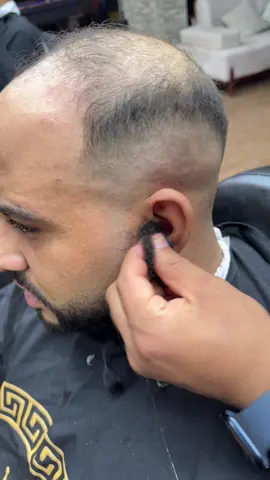 ازاله شعر الاذن بالشمع 😂💈  #sophymohamed #fyp #hashta #explore #viral 