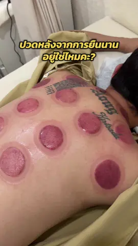 ยืนนานๆก็ปวดหลังไม่แพ้นั่งนานๆหรือยกของหนักเลยค่ะ #ครอบแก้ว #ครอบแก้วแก้ปวด #ปวดหลัง #ปวดคอบ่าไหล่ #ออฟฟิศซินโดรม 