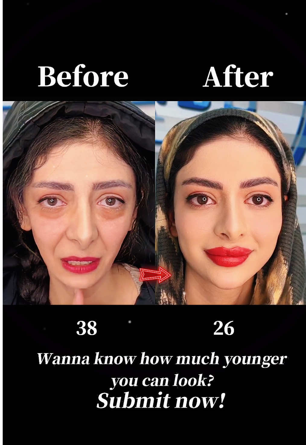 Your Youth, Your Power 💖 #Facelift #FaceLifting #AntiAging #YouthfulSkin #WrinkleFree #SkinTightening #GlowUp #BeautyTransformation #SkincareRoutine #AgelessBeauty #拉皮手术 #面部提升 #逆龄 #年轻无敌 #جمال_الشباب #شد_الوجه #بشرة_صافية #تجميل #سر_الجمال #العناية_بالبشرة 