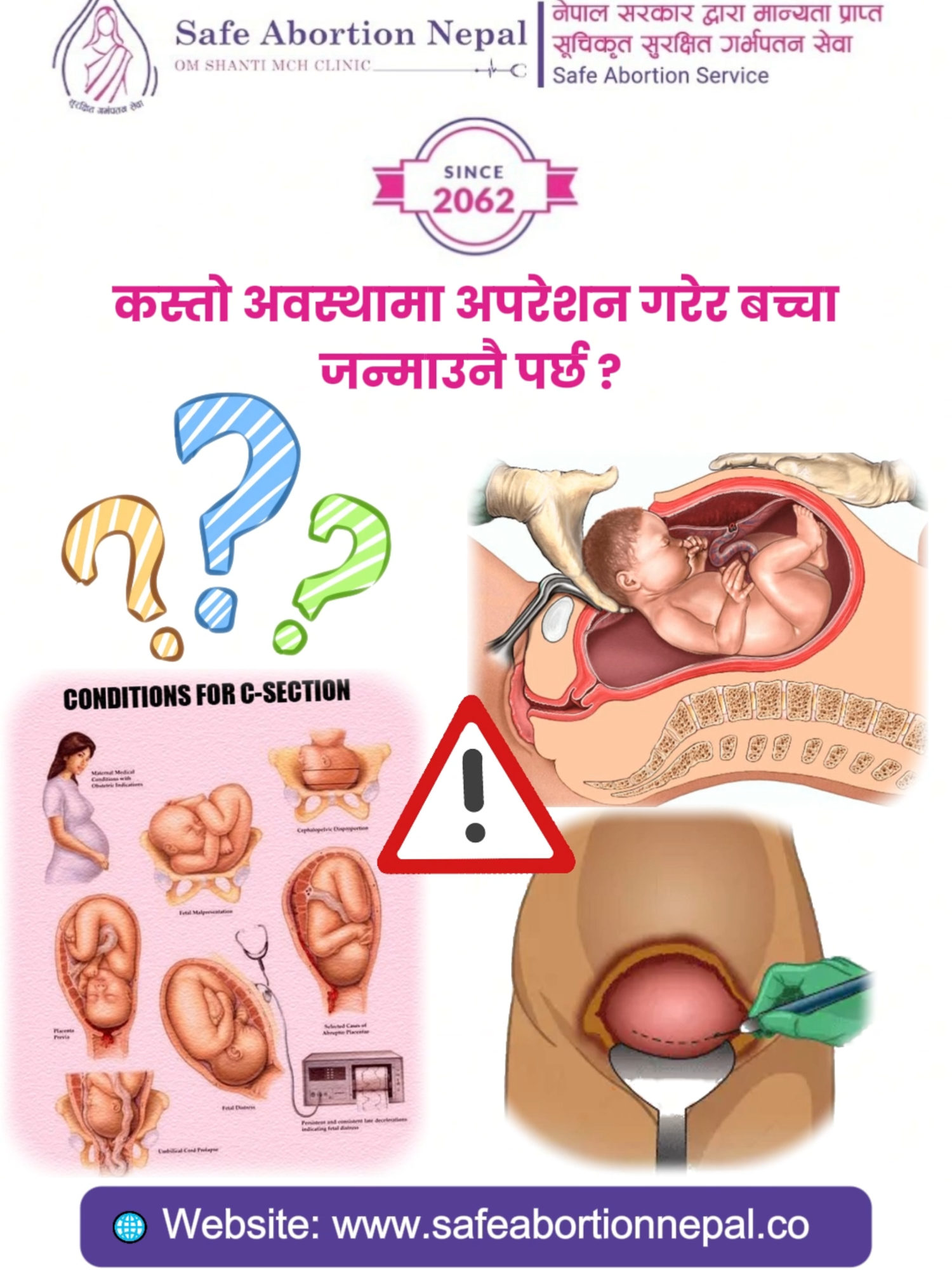 👩‍⚕️👶When is a C-Section Necessary ? A cesarean delivery (operation) becomes necessary in certain conditions such as: • Baby positioned upside down (breech) 🔄 • Multiple babies in the womb (twins or more) 👶👶 • Umbilical cord wrapped around or prolapsed 🔗 • Placenta positioned low (placenta previa) ⚠️ • Mother has health issues like high blood pressure, diabetes or eclampsia 💉 👉 In these cases, surgery ensures the safety of both mother and baby. 📍 Public awareness message by OM SHANTI MCH CLINIC. 🌸 Your Trusted Partner in Women’s Health🌸 📞 Call: 9841335339 | 01-4106883 🌐 Book Online: safeabortionnepal.com 📍 Locations: 🏥Shantinagar (Opp. Lions Eye Hospital) 🏥Ekantakuna (Near Gayatri Petrol Pump) 🏥Balkhu Chowk (Above Prabhu Bank) 💖 Care. Compassion. Confidentiality. 💖 . . . #pregnancy #pregnancyjourney #pregnant #pregnantlife #pregnancytest #pregnancytips #pregnancyhealth #pregnancyhealthcare #placentaprevia #placenta #twins #twinsbaby #twinmom #twinsisters #pregnancyconditions #women #womenhealth #womenhealthawareness #womenhealthtips #trend #trending #trendingsong #trending?song🔥 #foryoupageofficiall #foryoupage❤️❤️ #foryoupage #foryou #fypシ゚viral🖤tiktok #goviral #go #goviralgo