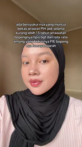 asal jgn pencetin jerawat pas meradang trs jerawat jgn di kopek2, pake skincare yg aman gak keras di kulit yaa #skincaretips #bopeng #scars #acnetreatment #acnefighter #acneproneskin 
