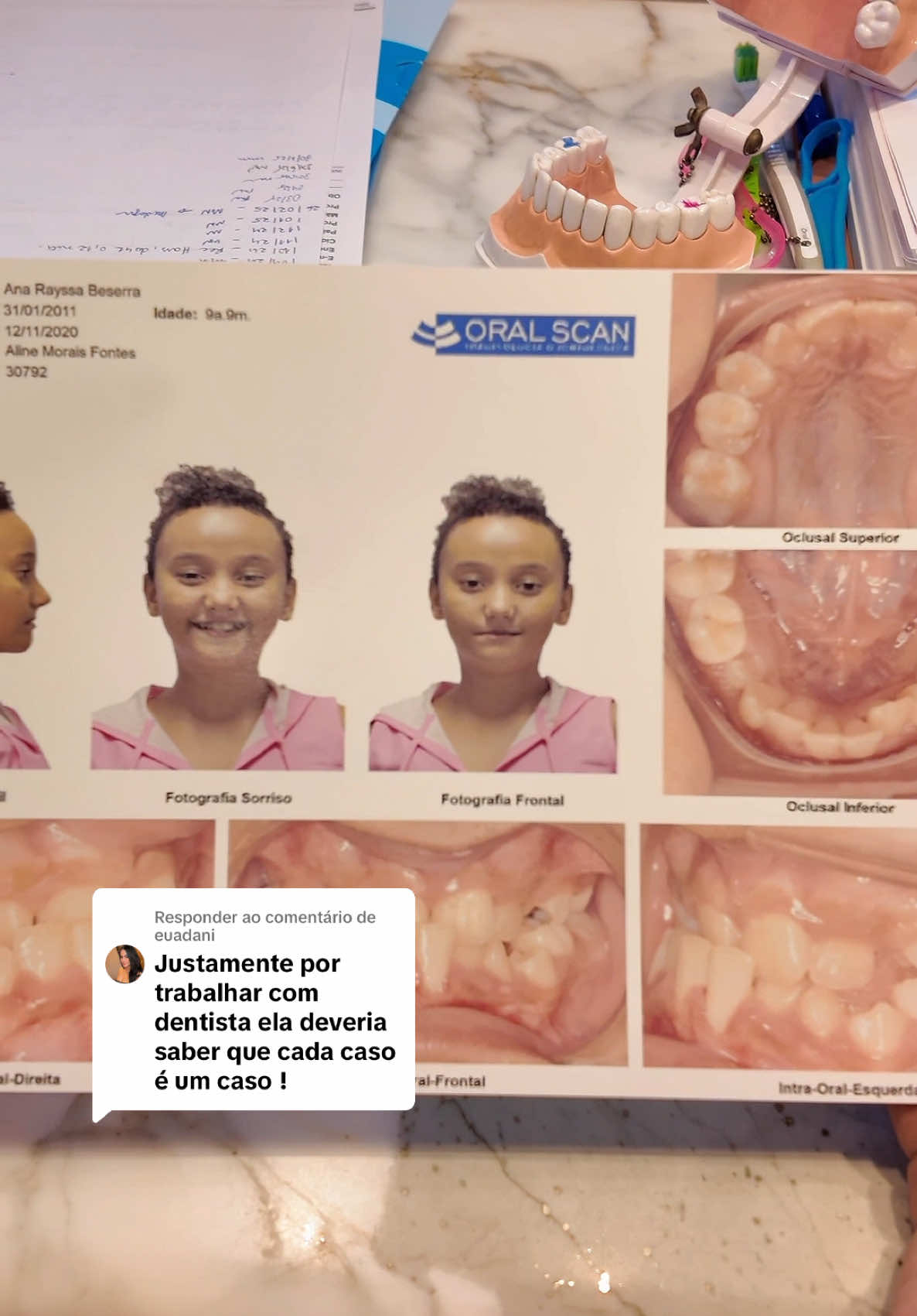 Respondendo a @euadani dia de dentista com o meu amorzão @Rayssatitiarayon e essa maravilhosa @Dra Aline Morais | Encantadora #fy #fyp #dente 