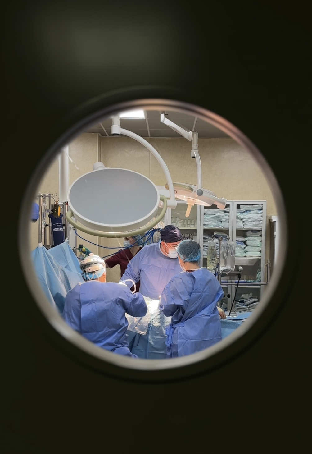 M-am născut cu sindromul Barlow – adică valvele inimii nu funcționau corect. Mult timp nu am avut niciun semn, până într-o zi, când pediatrul copiilor m-a ascultat și pe mine și mi-a recomandat să fac o ecografie. De acolo au început toate investigațiile și am aflat diagnosticul. Inițial nu plănuiam să fac operația prea curând, dar starea mea emoțională a agravat situația și nu mai puteam amâna. Am ajuns la Novamed, unde doctorul Stanislav Rurac mi-a făcut operația minim invazivă – fără să fie nevoie de tăieturi de os, exact cum îmi doream. Cel mai important pentru mine e că m-a operat printr-o tehnică modernă: nu mi-a înlocuit valva, ci a reparat-o. Asta înseamnă că nu voi depinde de pastile toată viața. Până atunci făceam toate investigațiile în București și eram sigură că acolo va fi și operația. Dar, întâmplător, am aflat că aceeași echipă de medici vine și în Moldova la Novamed, iar intervenția costă de două ori mai puțin. După prima discuție cu domnul Rurac am simțit că pot avea încredere și că sunt pe mâini bune. Mulțumesc din suflet domnului doctor, echipei sale și spitalului Novamed pentru profesionalism, grijă și pentru că mi-au dat curajul și sănătatea de care aveam nevoie 🧡 #novamed #operatie #barlow #inima #chisinau 