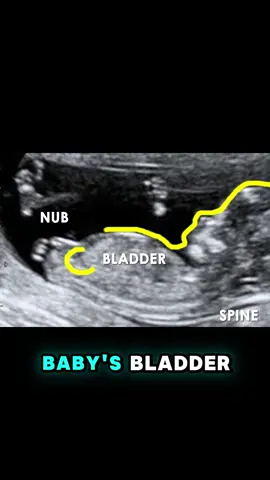 He or She? The link to the gender prediction app is in my profile 🩷💙 #momtobe #heorshe #pregnancy #nubxapp