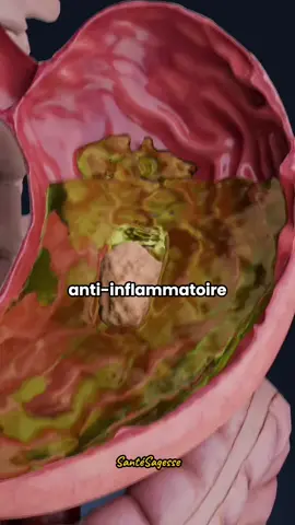 Le meilleur aliment anti-inflammatoire au monde n’est ni le gingembre, ni le curcuma, et même pas l’ail. Il existe quelque chose d’encore plus puissant. Dans la médecine ancienne, on l’appelait « le remède à tout… sauf à la mort ». Ses bienfaits sont nombreux : •Elle réduit les douleurs et les inflammations. •Elle renforce le système immunitaire. •Elle lutte contre les ballonnements et les troubles digestifs. •Elle soutient le foie. •Elle apaise l’acné, l’eczéma, hydrate la peau et stimule la repousse des cheveux. •Elle soulage l’asthme et les allergies grâce à ses propriétés bronchodilatatrices. _Dites-moi dans les commentaires si vous connaissez cet aliment avant cette vidéo, et n’oubliez pas de vous abonner pour plus de vidéos. #santé #santénaturelle #blackseed #homme #femme 