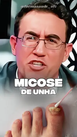 Tratamento natural para MICOSE DE UNHA!  🗣️ Dr. Tiago Rocha 🎥 Palestrante Tiago Rocha 🎥 Curitiba PodCast #saude #micose #micosedeunha #saudavel 