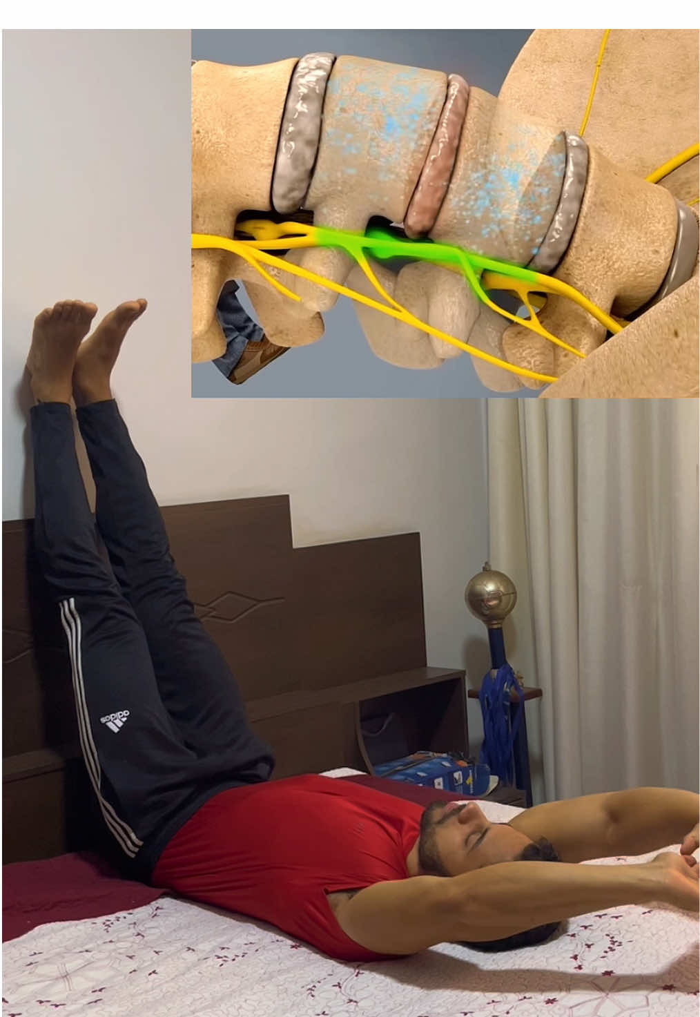 Como aliviar a dor na coluna! #dornascostas #dorlombar #herniadedisco #ciatica 
