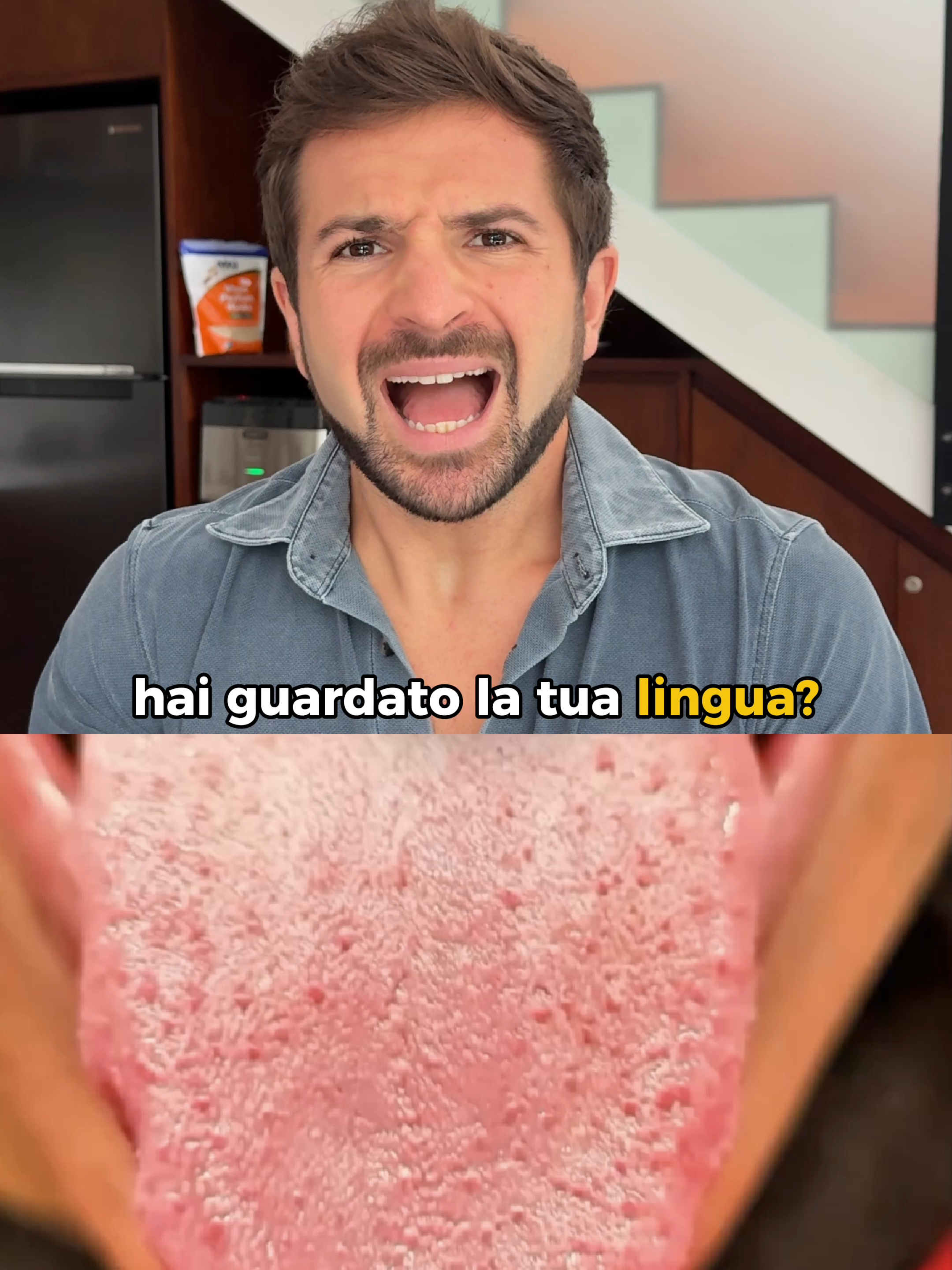 👅 LA MAPPA DELLA SALUTE: 🔴 CREPE SUL LATO DELLA LINGUA: Il tuo fegato è in difficoltà. Un fegato che non funziona bene non metabolizza grassi e tossine. ❤️ ALTERAZIONI SULLA PUNTA: Possibile rischio di malattie cardiovascolari, polmonari o respiratorie. Circolazione compromessa = metabolismo rallentato. ⚪ LINGUA BIANCA: • Disbiosi intestinale (batteri cattivi vincono su quelli buoni) • Pessimo assorbimento di ferro (stanchezza cronica) • Basse difese immunitarie (ti ammali spesso) 🦷 SEGNI DEI DENTI SUI BORDI: La tua tiroide è malata. Tiroide lenta = metabolismo fermo = impossibile dimagrire. 🟡 LINGUA GIALLASTRA: Fegato malato. Il fegato è la tua 