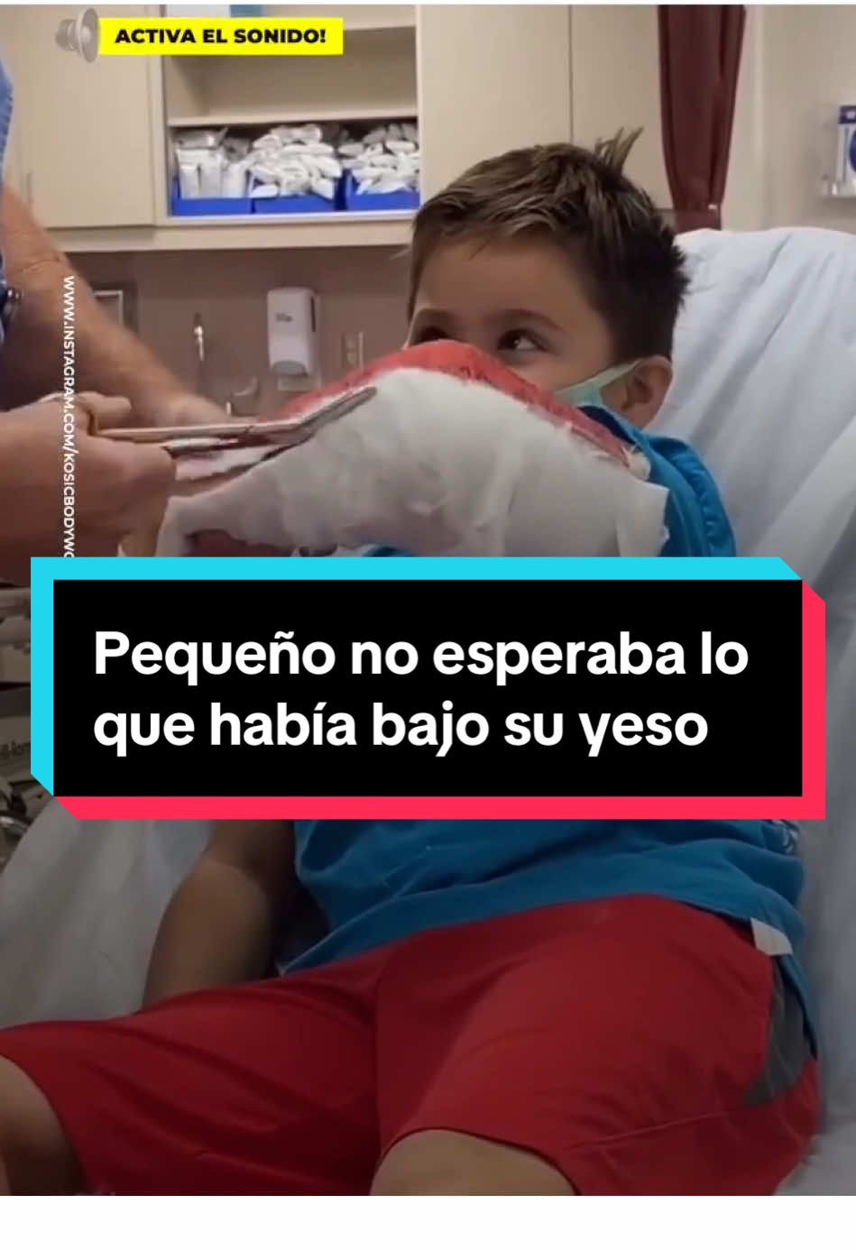 Pequeño no esperaba lo que había bajo su yeso #entretenews #viral #vida #anecdota #yeso