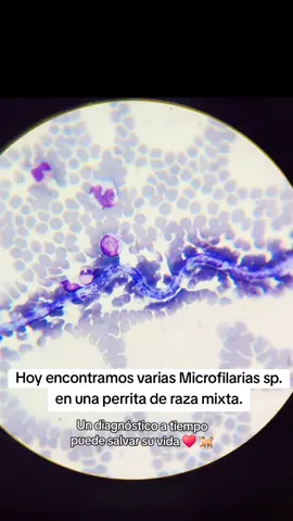 🔬 Al microscopio descubrimos una microfilaria en la sangre de una perrita mestiza. Estas diminutas larvas, transmitidas por mosquitos, pueden convertirse en el temido gusano del corazón. 🪱💔 Un diagnóstico a tiempo puede salvar su vida. 🐶✨ 👉 Escucha a tu mascota… a veces, lo más pequeño en su sangre revela lo más grande en su corazón. Llévala a revisión. ❤️ 🐕  #microscopio #microfilaria #Veterinaria #fypシ゚viral🖤tiktok #LabVet 
