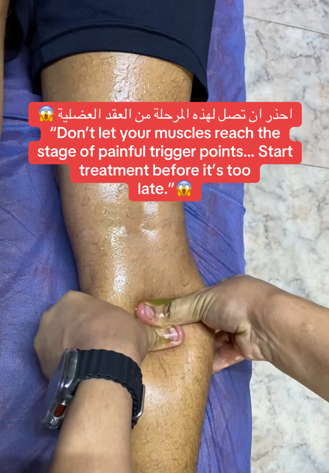 #حمض_اللاكتيك #الم_العضلات #الاجهاد_العضلي #العقد_العضلية #lacticacid #dr_mohamed_abdelaziz 