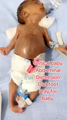 #creatorsearchinsights #unfrezzmyaccount #sofa #NewbornHealth #CriticalCare @Alifa Mousda4400 zkneonatalcare YouTube channel 