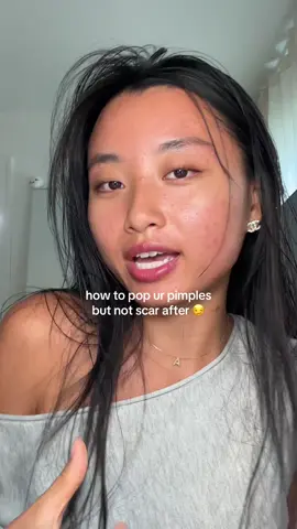 its all about the skincare after so ur skin doesnt breakout with more acne😏 #acne #pimples #acneproneskin #acnejourney  @anua_global azeliac acid serum  @iUNIK beta glucan serum  @Vanicream™ Sensitive Skin Care facial moisturizer 