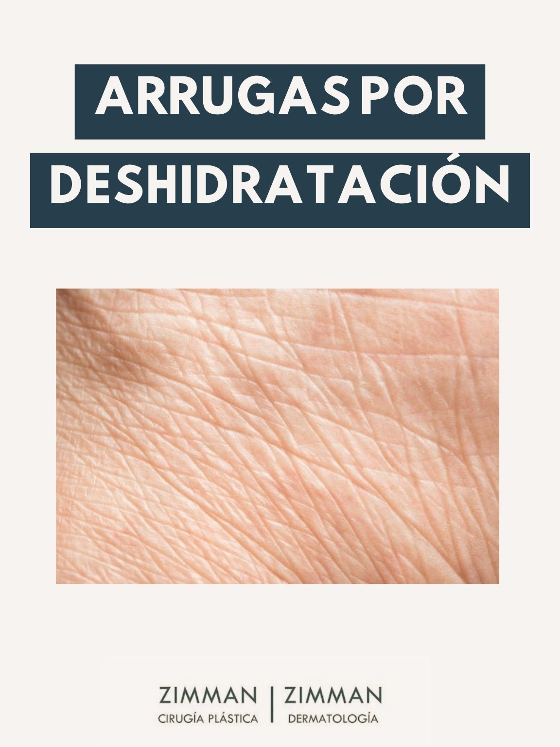 Estas son arrugas por deshidratación. Hidratando bien la piel, mejoran un montón 😉 Dra. Sabina Zimman 👩🏻‍⚕️ Ig @centrozimman  #arrugas #deshidratacion #pielarrugada #centrozimman