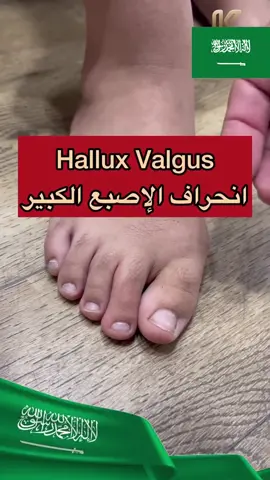 عـــرض لمــدة 3 أيـــام فقط