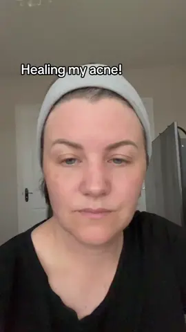 Healing acne without stripping the skin barrier  #acneproneskin #acneskincare #acnepositivity 
