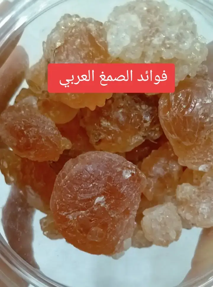 الصمغ العربي هو مادة طبيعية غنية بالألياف وله فوائد صحية متعددة، أبرزها تحسين صحة الجهاز الهضمي بتنظيم حركة الأمعاء وتعزيز البكتيريا النافعة، ودعم وظائف الكلى، وخفض مستويات الكوليسترول والسكر في الدم، والمساعدة في إنقاص الوزن عن طريق زيادة الشعور بالشبع، وتقليل الالتهابات، ودعم صحة القلب والأوعية الدموية، كما أنه يستخدم في علاج بعض المشاكل الجلدية  فوائد الصمغ العربي الصحية والغذائية لصحة الجهاز الهضمي: يُحسن الهضم: بفضل احتوائه على ألياف قابلة للذوبان تعزز حركة الأمعاء.  يعمل كبريبايوتك: لتغذية البكتيريا النافعة في الأمعاء، مما يحسن صحة القولون  يقلل من أعراض القولون العصبي: مثل الإسهال والإمساك، ويعتبر منخفض الفودماب (FODMAPs)  يساعد في تليين البراز: والوقاية من الإمساك.  لدعم وظائف الجسم: يعزز صحة الكلى: عن طريق تقليل تراكم السموم في الجسم  يساعد على خفض مستويات الكوليسترول: الضار في الدم  قد يساعد في خفض سكر الدم: بتحسين حساسية الأنسولين  يحتوي على مضادات أكسدة: تدعم مناعة الجسم بشكل عام.  للتخسيس والتحكم بالوزن: يزيد الشعور بالشبع: ويقلل من كمية الطعام المتناولة، مما يساهم في إنقاص الوزن  يساعد في التخلص من السموم: والفضلات الناتجة عن حميات إنقاص الوزن.  لصحة الجلد: يساعد على ترطيب البشرة: وتقليل التجاعيد.  يعمل على تفتيح لون البشرة: وإزالة التصبغات عند استخدامه بانتظام.  #CapCut  #الخميس 