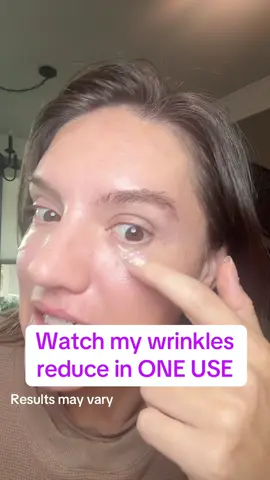 @Peter Thomas Roth Labs collagen eye patches #collagenpatches #eyepatches #undereyecare #antiagingtips #beautyfinds 