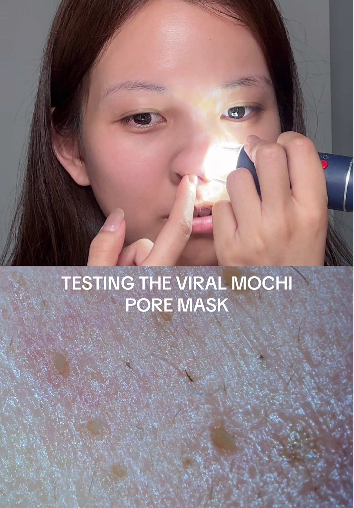 Testing the viral @Arencia Rice Mochi Cleanser as a pore mask using a skin microscope! 🔬  #Arencia #RiceMochiCleanser #MochiCleanser #Serum #Acne #sebaceousfilament #pores