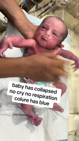 no response coloure blue no respiration #newbornbaby #unfreezemyacount #usa🇺🇸 