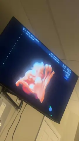 4D Ultrasound 🤎