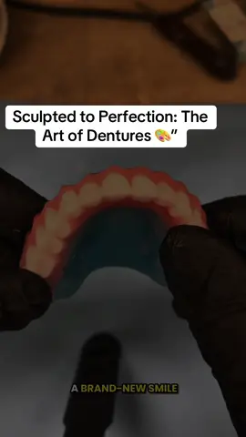Watch as this wax denture try-in transforms into a lifelike smile. Every curve, every detail, every line of the gum base is sculpted with precision — because dentures aren’t just replacements, they’re works of art. This stage allows us to perfect comfort, bite, and esthetics before the final finish. A true denture artist doesn’t just make teeth… they restore confidence, identity, and the beauty of a natural smile. #D#DenturesS#SmileTransformationD#DentalCraftsmanshipW#WaxTryInNewSmile
